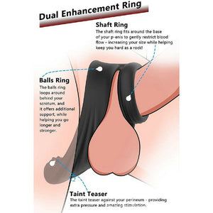 Male Prostate Massager Anal Butt Plug Penis Cock Ring Sex Toys For Men Couple US